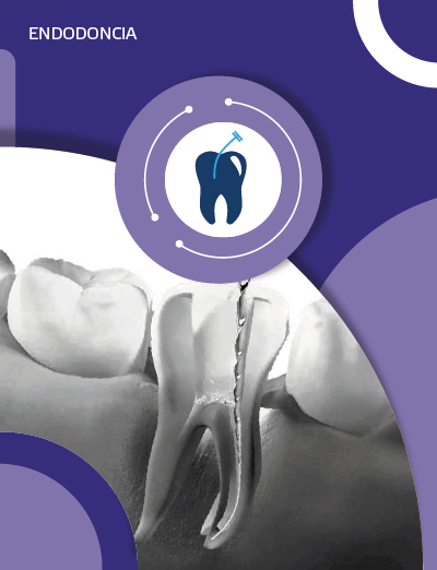 Catálogo de Endodoncia