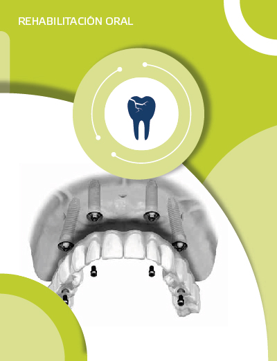 Catálogo de Rehabilitación Oral